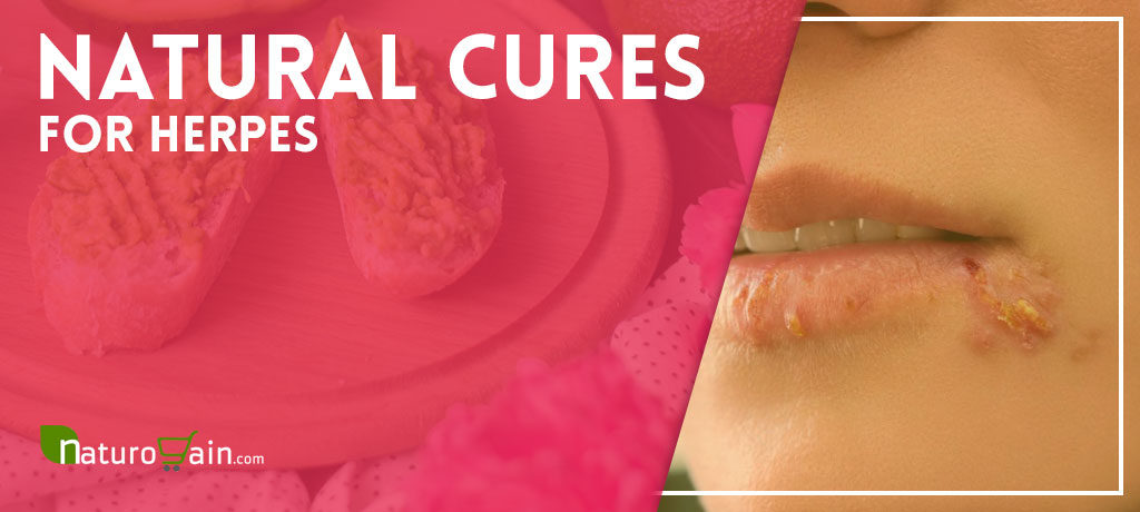 Natural Cures for Herpes