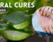 Natural Cures for Psoriasis