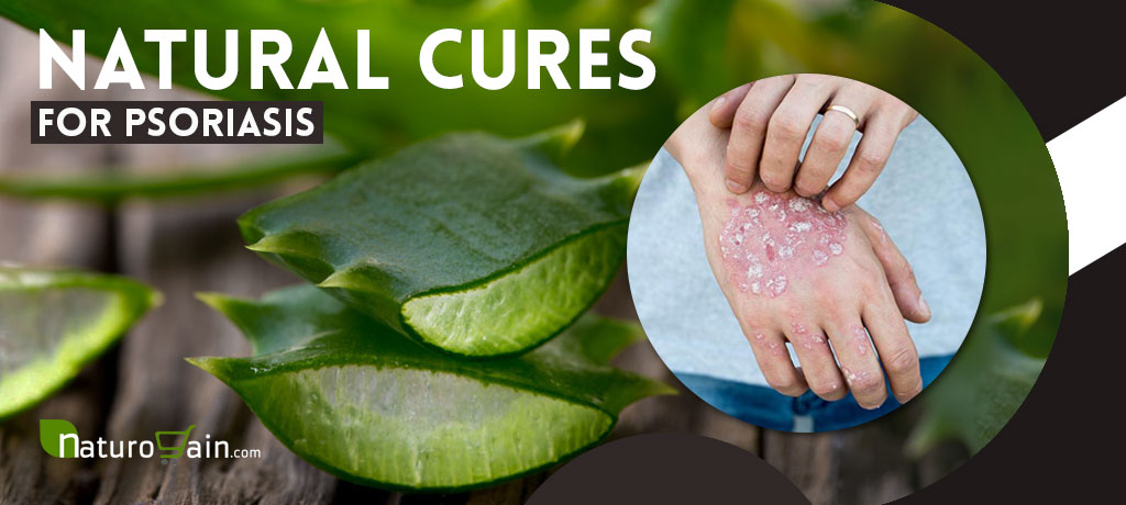 Natural Cures for Psoriasis