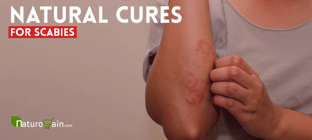 Natural Cures for Scabies