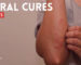 Natural Cures for Scabies