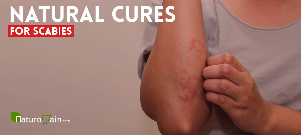 Natural Cures for Scabies