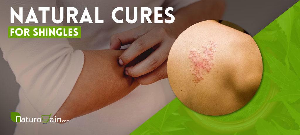 Natural Cures for Shingles