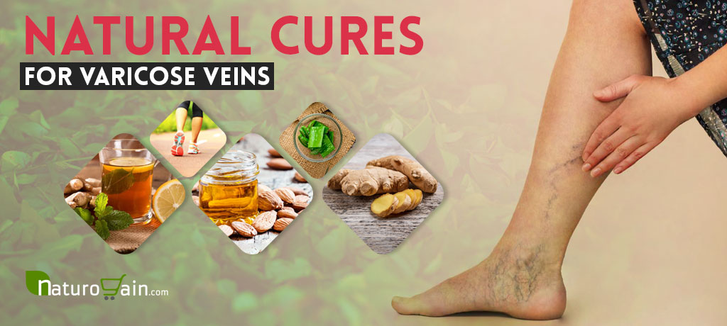 Natural Cures for Varicose Veins