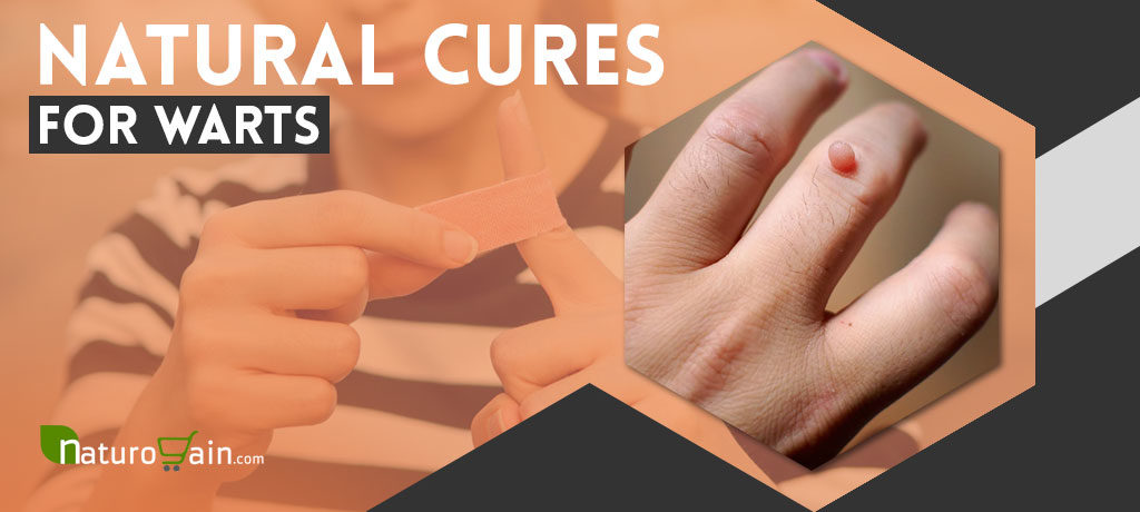 Natural Cures for Warts