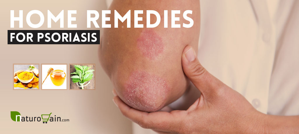 Best Home Remedies for Psoriasis