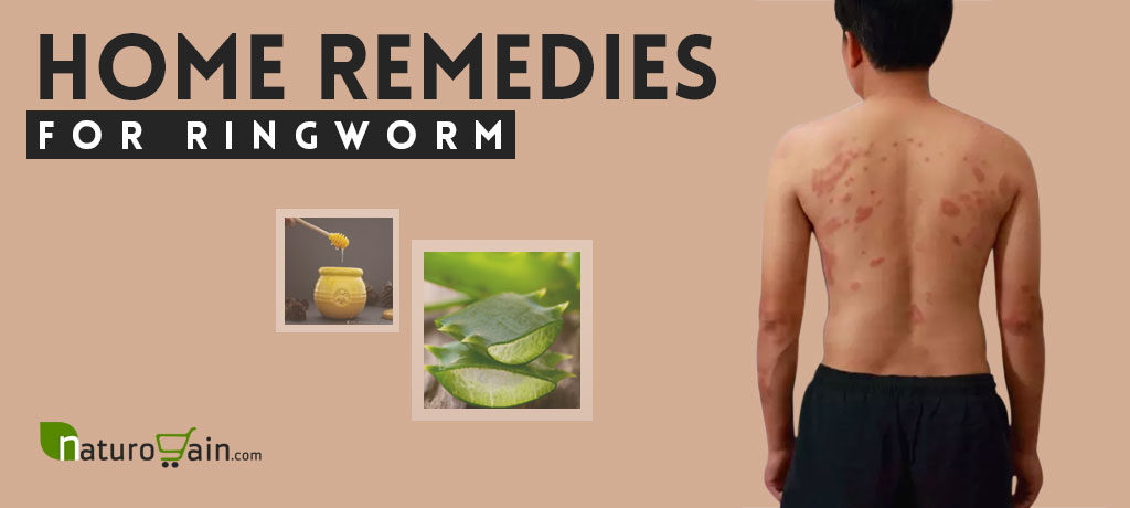 Best Home Remedies for Ringworm