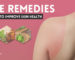 Best Home Remedies for Sunburn