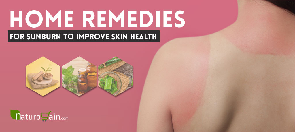 Best Home Remedies for Sunburn