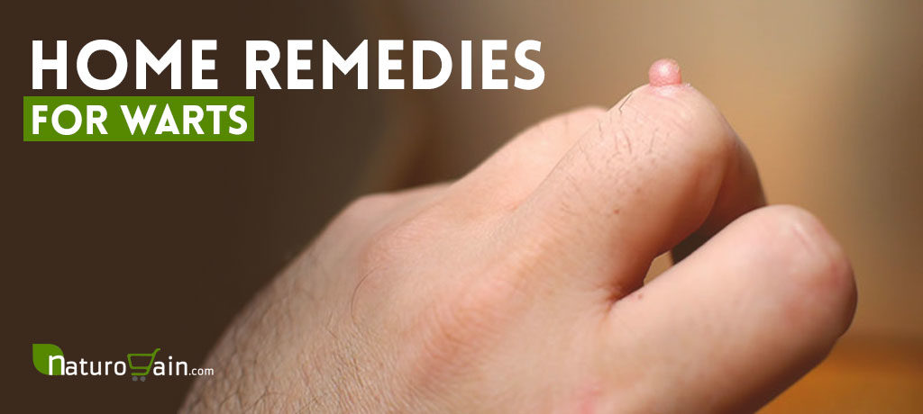 Best Home Remedies for Warts