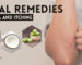 Herbal Remedies for Eczema