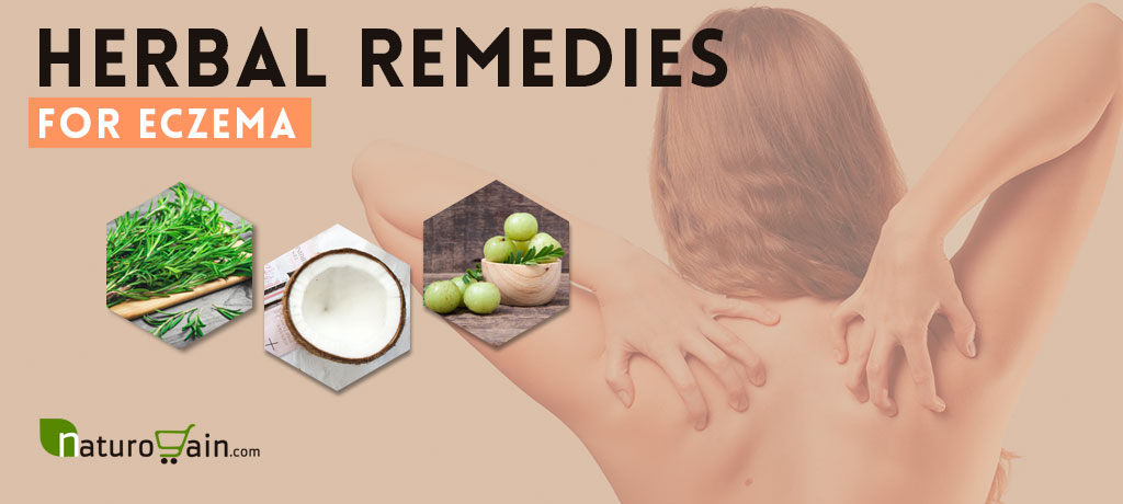 7 Powerful Herbal Remedies for Eczema - Treat Eczema [Naturally]