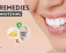 Best Home Remedies for Teeth Whitening