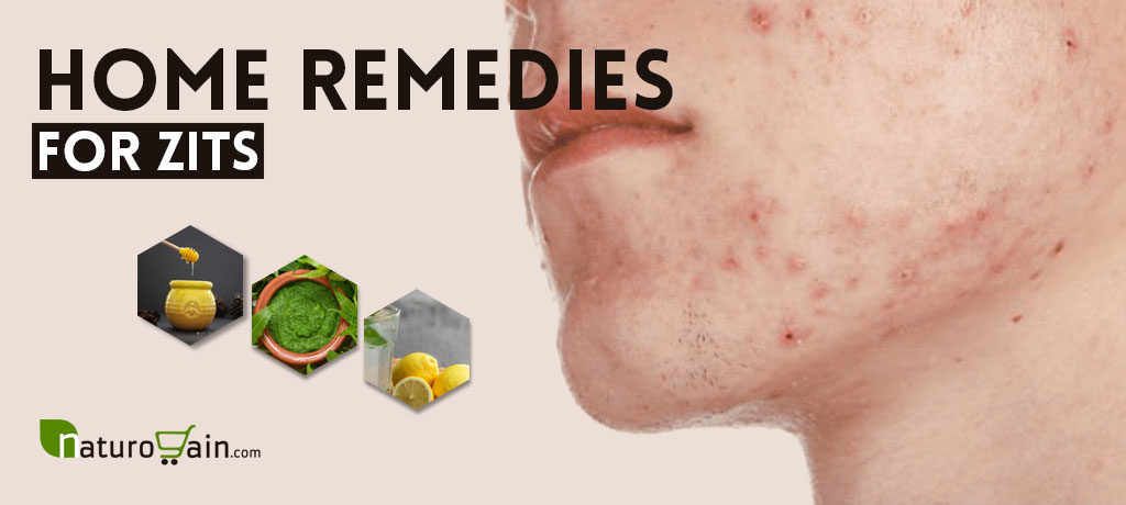 Home Remedies for Zits