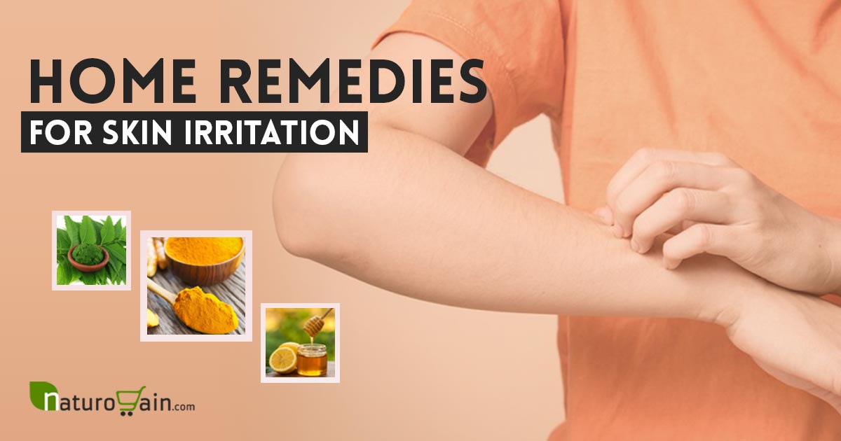 9 Best Home Remedies for Skin Irritation to Prevent Rashes